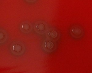 pneumococcus hemolysis on blood agar